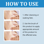 Ximonth Quick Liquid, Brothers, Warts Corns Moles Skin Proud Flesh Smooth Skin Clean And Care