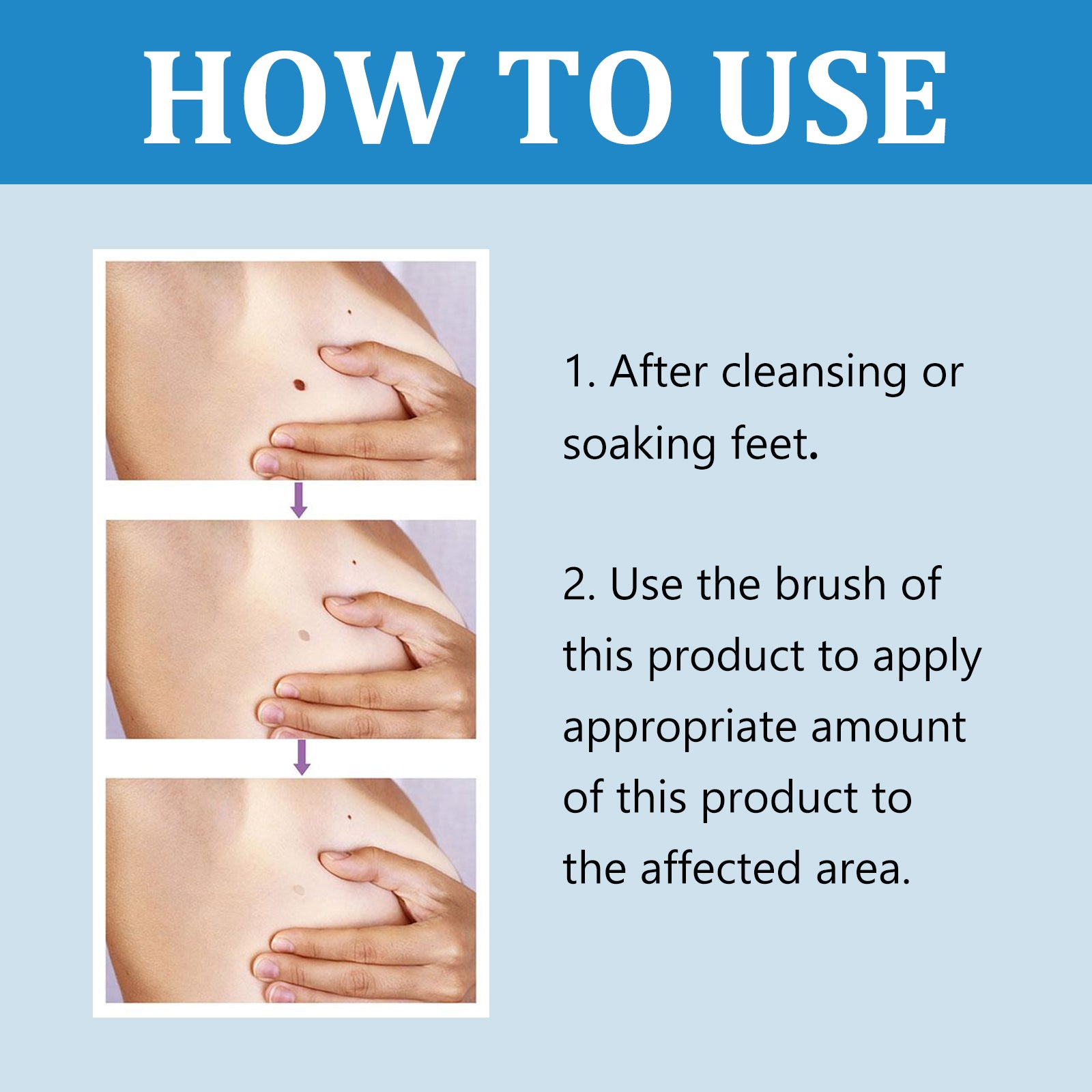 Ximonth Quick Liquid, Brothers, Warts Corns Moles Skin Proud Flesh Smooth Skin Clean And Care