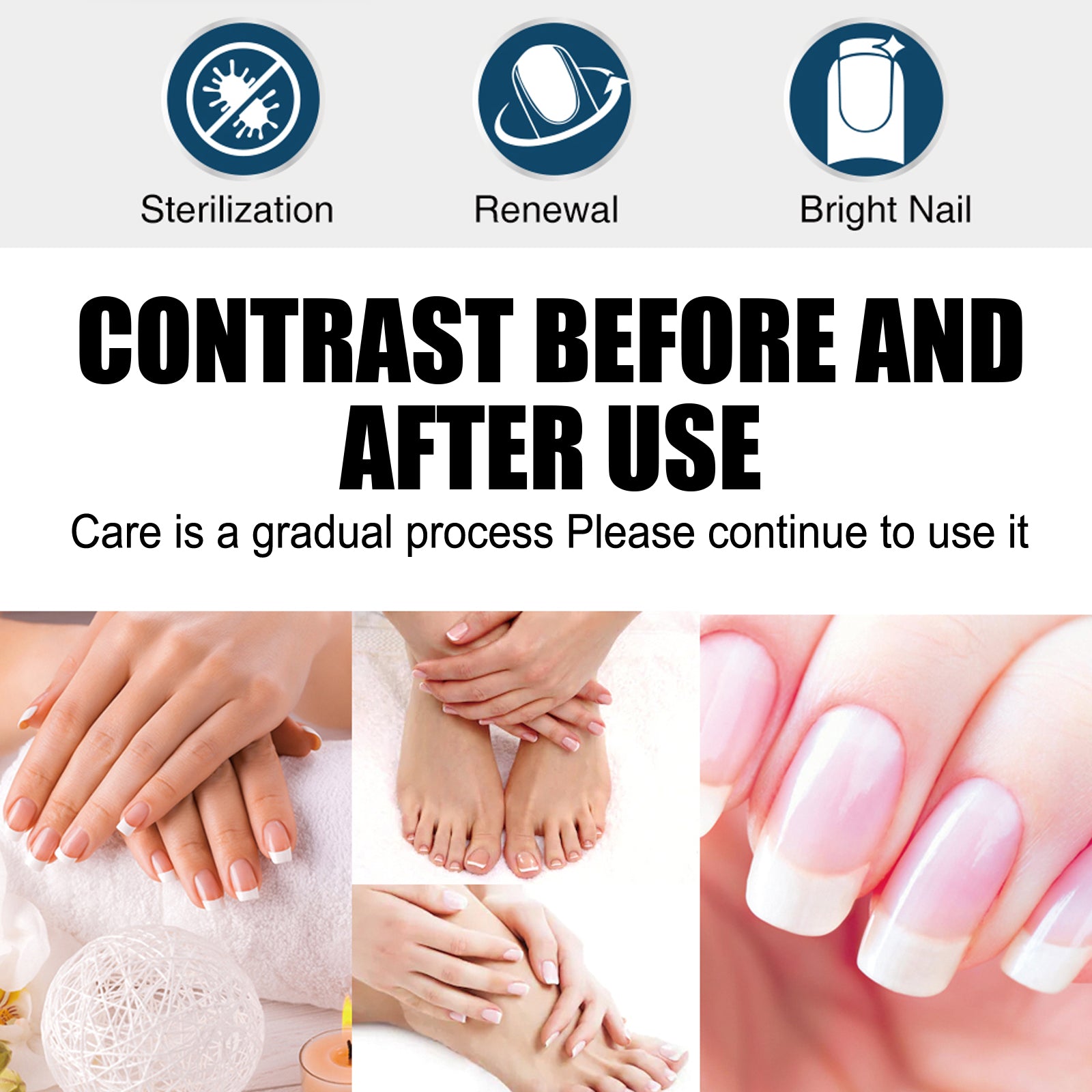 South Moon Exstroyeza Pen, Hand And Foot Gray Nail Repair Gray Nail Solution Thickening Nutritional Repair Solution