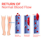 Acupressure Arch Support Insoles with Massage Nodes