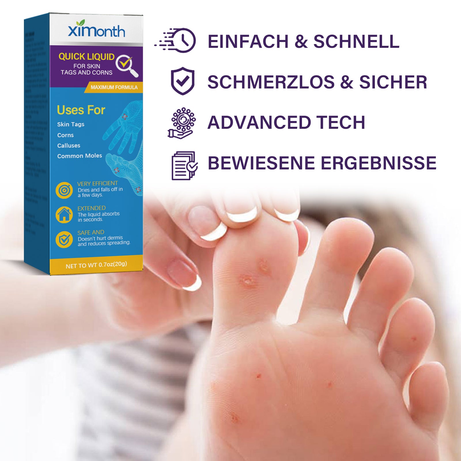 Ximonth Quick Liquid, Brothers, Warts Corns Moles Skin Proud Flesh Smooth Skin Clean And Care