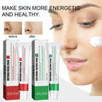 EELHOE Skin Care Cream Improves Dull Skin, Moisturizes Skin, Brightened Skin Care Cream And Clears Acne