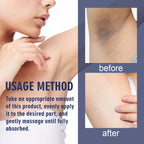 OUHOE Underarm Care Cream Knee Knuckle Elbow Armpit Dull Moisturizing Cleansing Skin Beauty Cream