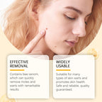 Ximonth Kew Mole Cream Gently Cleanses Skin And Lubrates Rejuvenating Herbal Body Care Cream