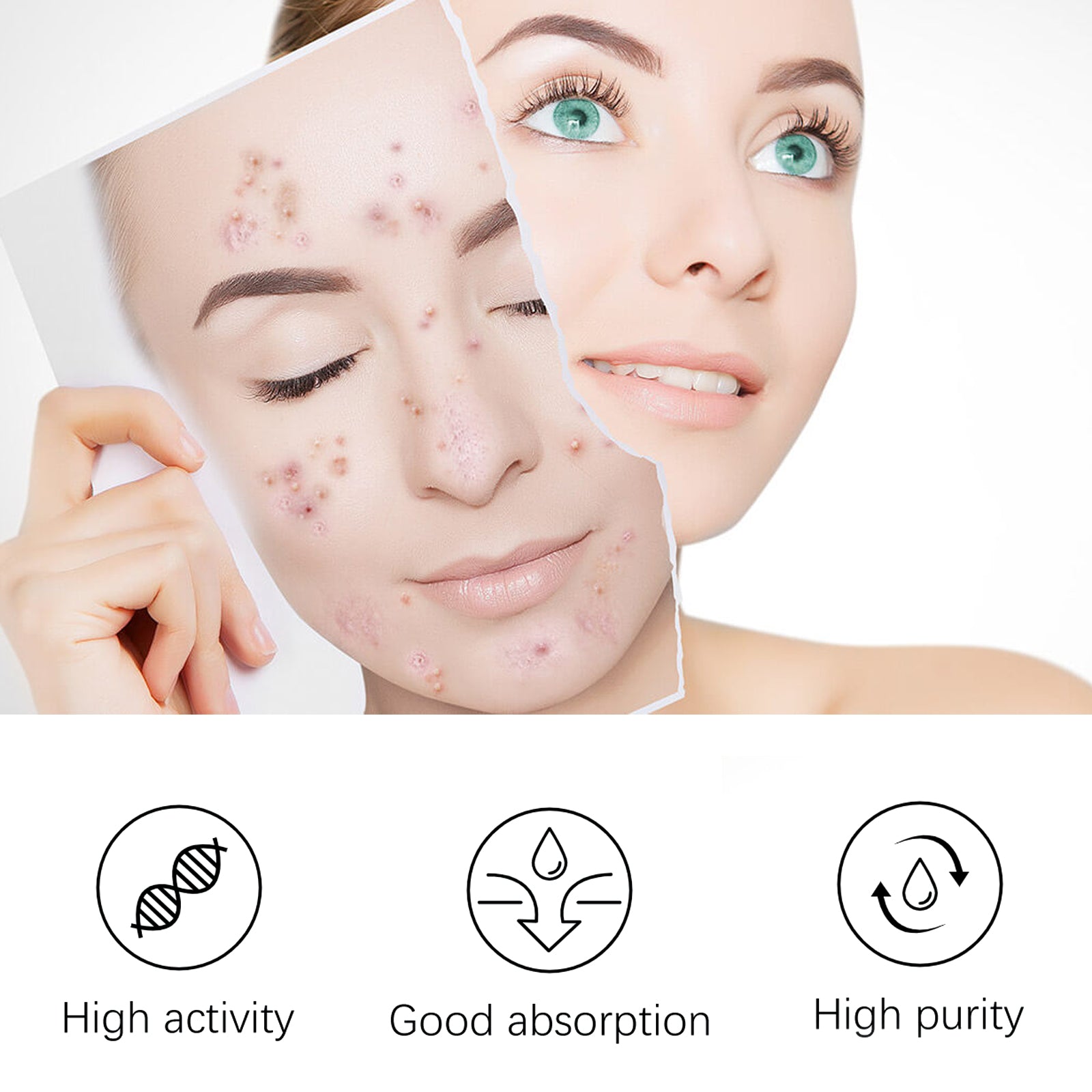 EELHOE Blemish Smoothing Lotion, Reduce Closed Mouth Acne Acne Spot Removal Repair Skin Lotion