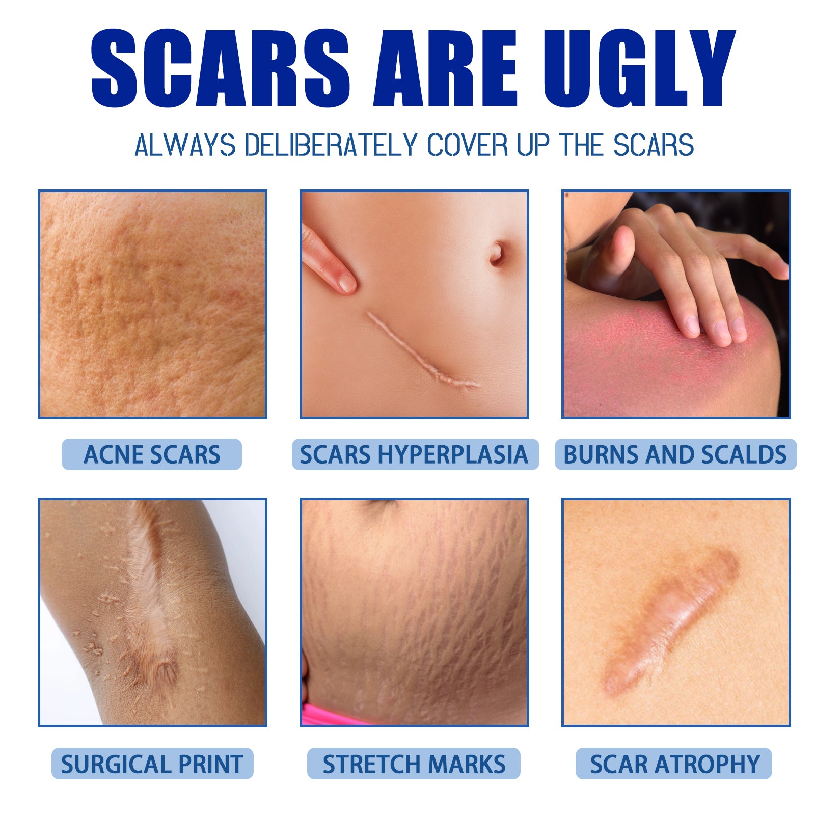 Jaysuing Scar Cream, Fade Scars Smooth And Firming Skin Repair Cream