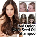 Red Onion & Black Seed Hair Oil for Dry, Damaged Hair