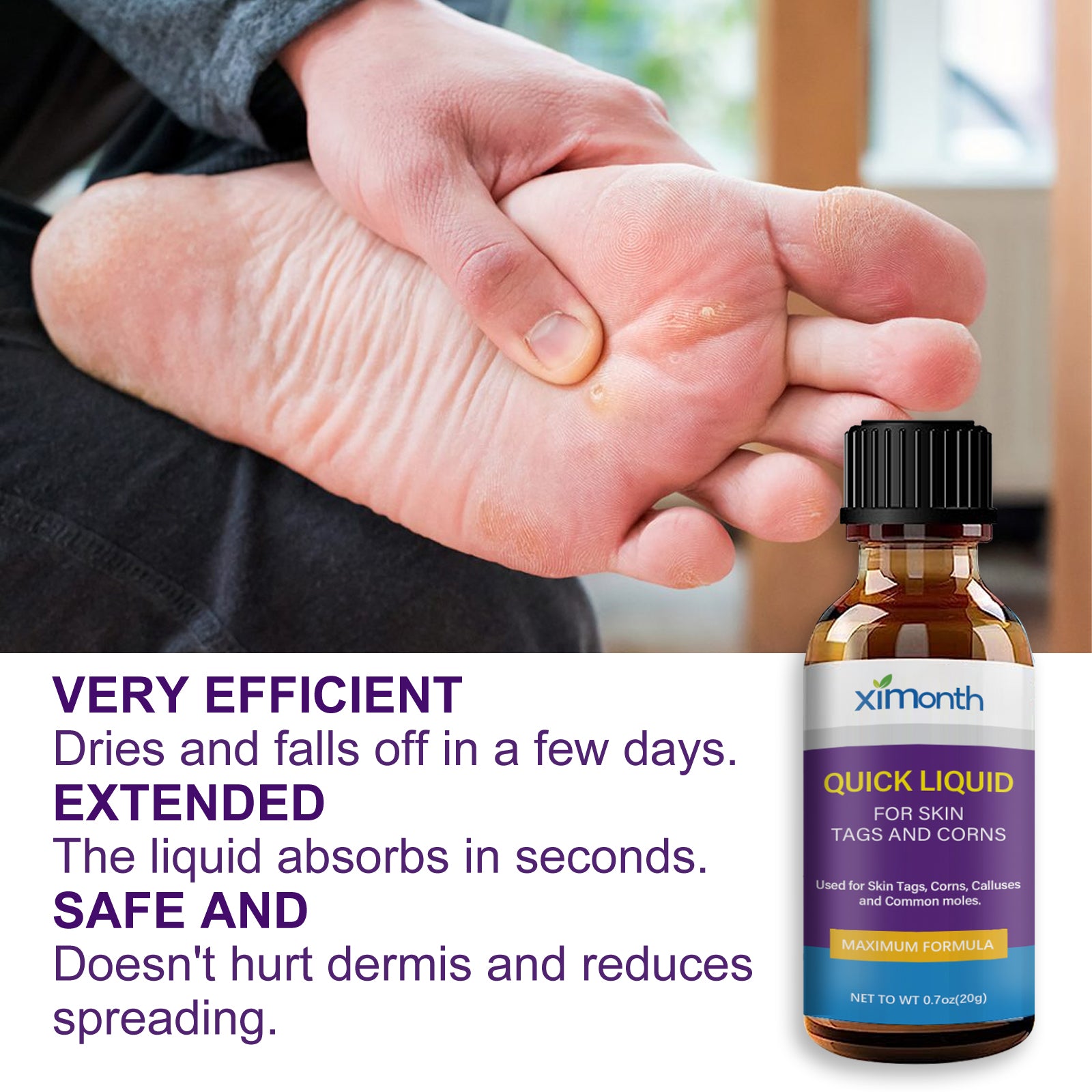 Ximonth Quick Liquid, Brothers, Warts Corns Moles Skin Proud Flesh Smooth Skin Clean And Care