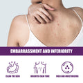 EELHOE Body Exfoliating Gel - Lavender Set, For Skin Cleansing, Back Acne Scrubbing, Improving Dull Skin, Bath Towel