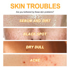 EELHOE Exfoliating Gel For Deep Cleansing, Anti-Acne Blackheads, Moisturizing Skin, Shrinking Pores And Brightening Gel