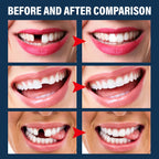 EELHOE Denture Decorative Teether Set, Halloween Vampire Makeup Dress Up Fake Tooth Glue Teeth Props