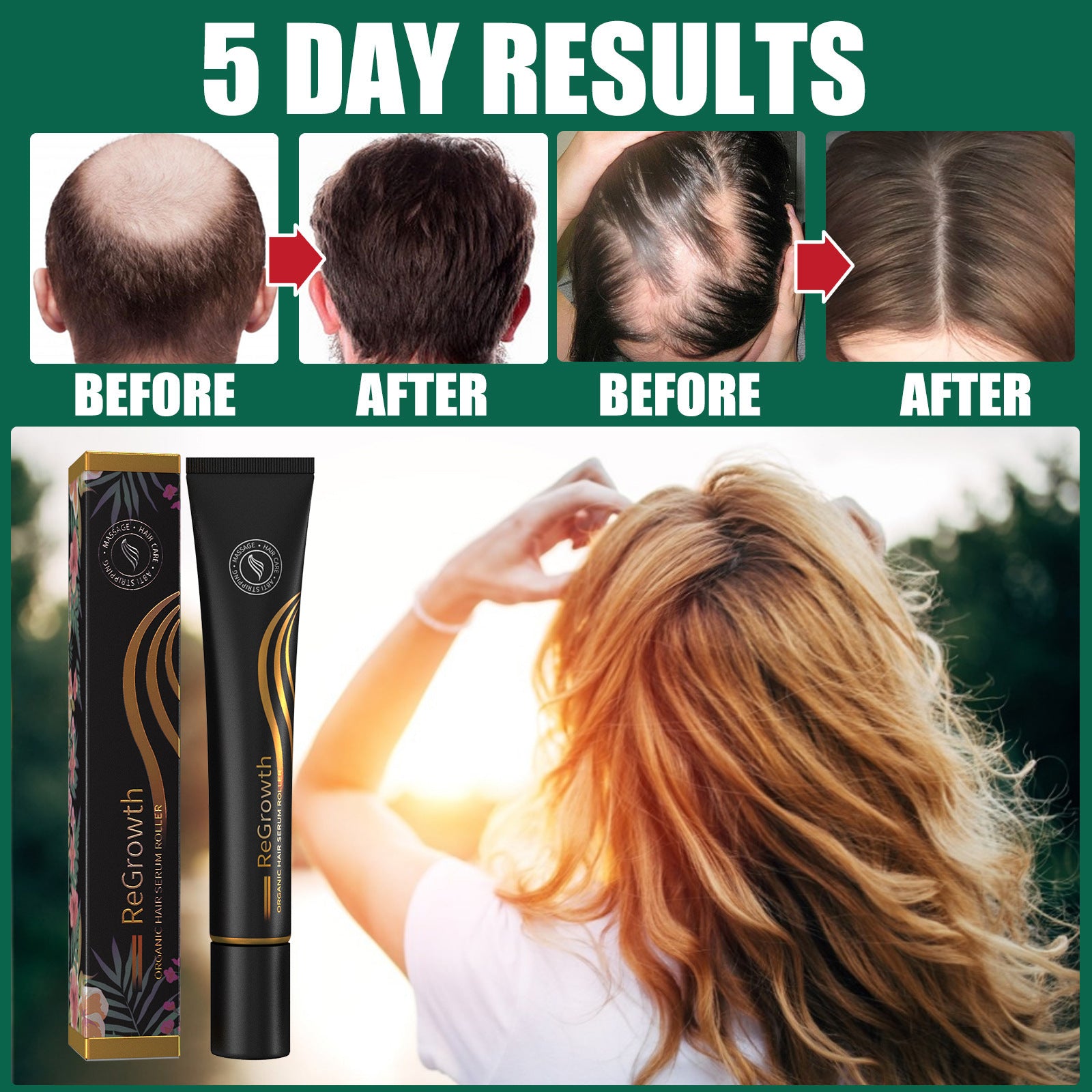 EELHOE Ball Massage Thickening Long Hair Lotion, Thick Thin Hair Anti-Breaking Hair Nourishing Hair Rolling Bead Massage Treatment