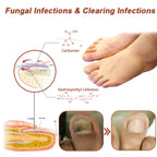 South Moon Nail Care Phototherapy Device, Repair Hands And Feet Gray Nails Yellow Ingrown Nail Soft Nail Care