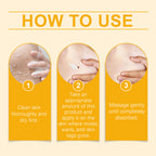 Ximonth Kew Mole Cream Gently Cleanses Skin And Lubrates Rejuvenating Herbal Body Care Cream