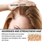 WoodSleep Hair Care Essential Oil For Damaged Hair Strengthens, Strengthens, Nourishes, Roots And Thickens Hairline Essential Oil