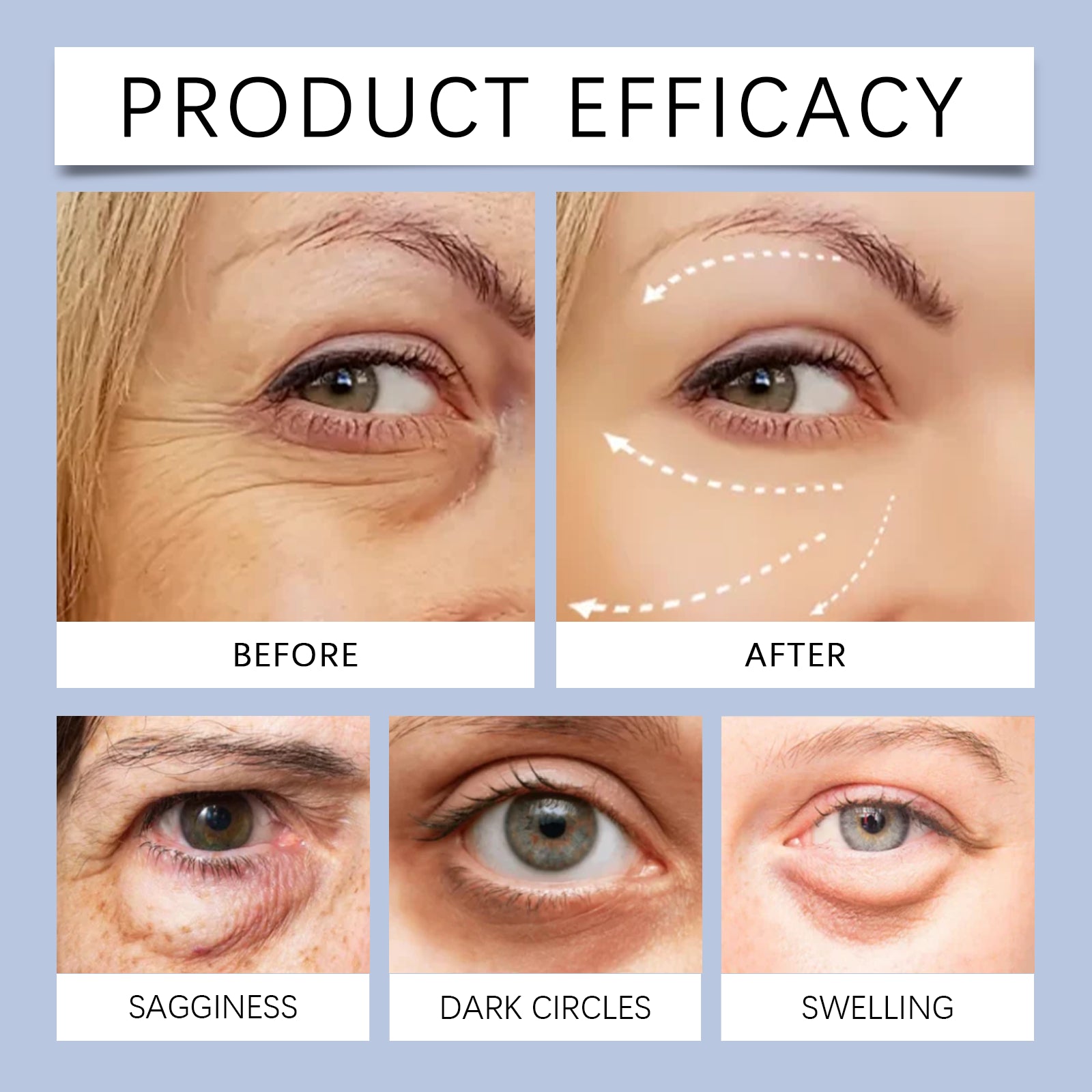 EOHOE Electric Eye Cream Gently Moisturizes And Cares For The Eyes, Nourishing And Softening The Skin Around The Eyes. Daily Care Eye Cream